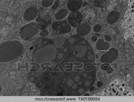 Las mejores marcas de microscopio electronico transmision lisosomes