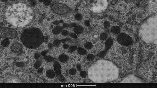 Las mejores marcas de microscopios electrónico transmision