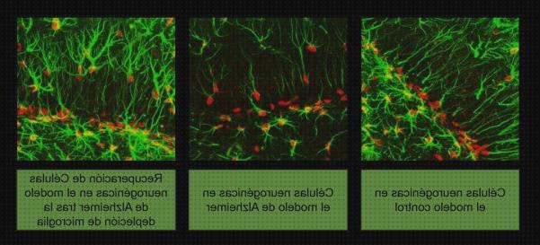 Opiniones de los 13 mejores Microscopios Optico Amiloide Tisulares