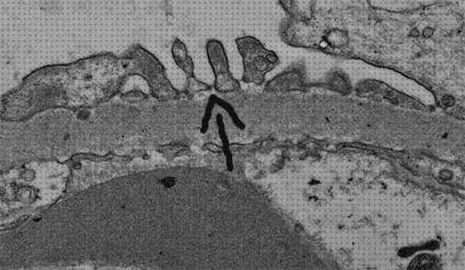 Las mejores marcas de glomerulo microscopio optico glomerulo normal