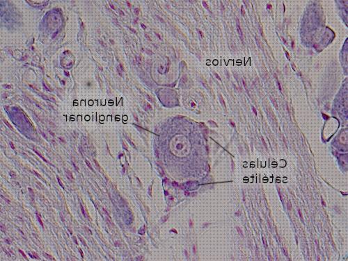 Las mejores marcas de microscopio optico nervio raquideo