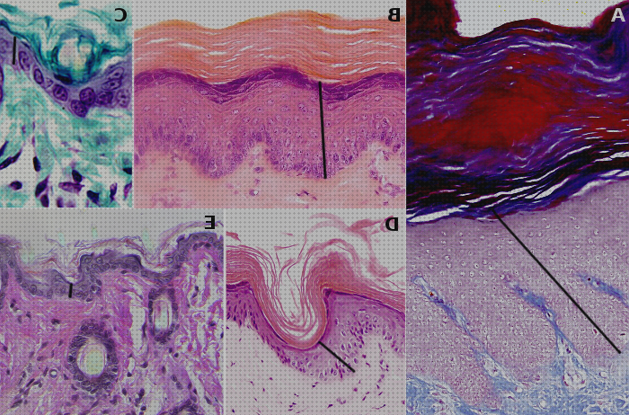 ¿Dónde poder comprar microscopios microscopios opticos epidermis?