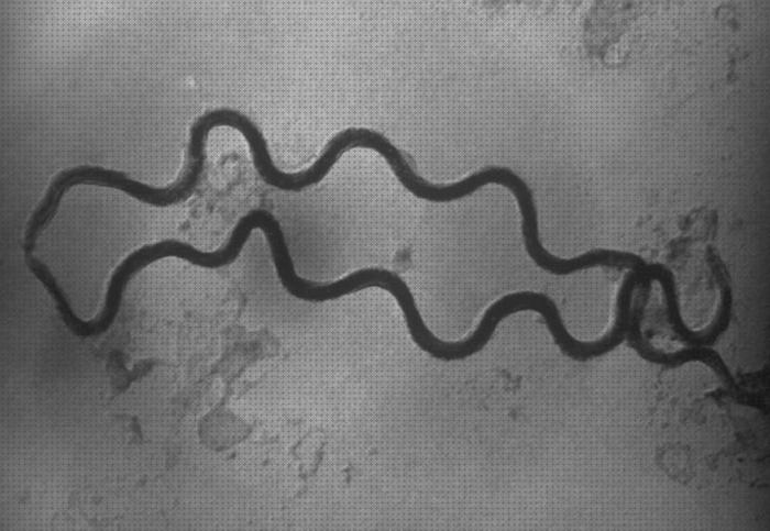 Las mejores marcas de ópticos microscopios microscopio optico espiroqueta