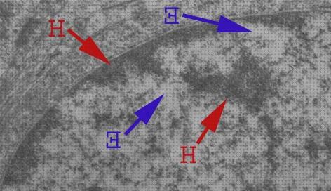 ¿Dónde poder comprar eucromatico nucleo eucromatico microscopio electronico?