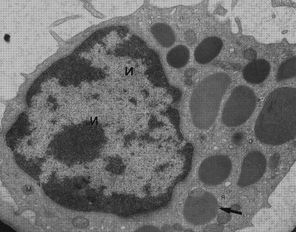 Análisis de los 19 mejores Nucleo Eucromatico Microscopios Electronicos