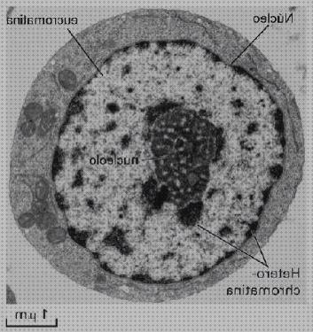 Las mejores marcas de eucromatico nucleo eucromatico microscopio electronico