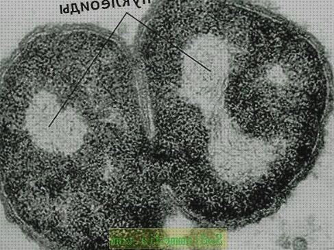 ¿Dónde poder comprar nucleoide nucleoide microscopio electronico?