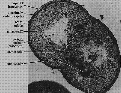 Review de nucleoide microscopio electronico