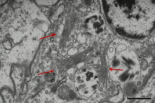 Mejores 34 nucleoloen microscopios electronicos