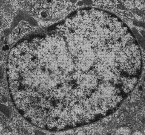 Los 37 Mejores nucleoporinas microscopios electronicos para comprar