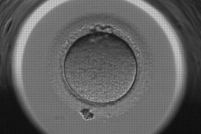 Los 16 Mejores Núcleos Profase Microscopios Electronicos