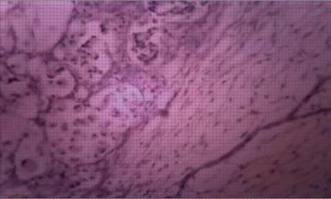 Las mejores marcas de Más sobre binocular 8x36 Más sobre estereomicroscopio binocular Más sobre minox 62216 binocular ovario binocular