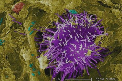 Análisis de los 29 mejores sida microscopios bajo análisis